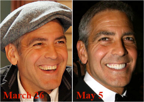 Clooney