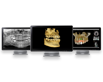 Images.3D Imaging.CS 8100 SC 3D