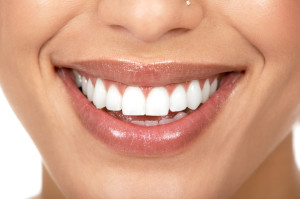 Dentista express: low cost, low time