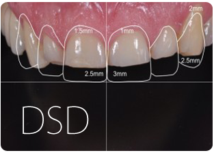 Digital Smile Design: tecnologia al servizio del sorriso!