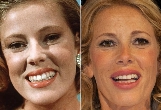 marcuzzi sorriso
