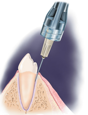 sta system2