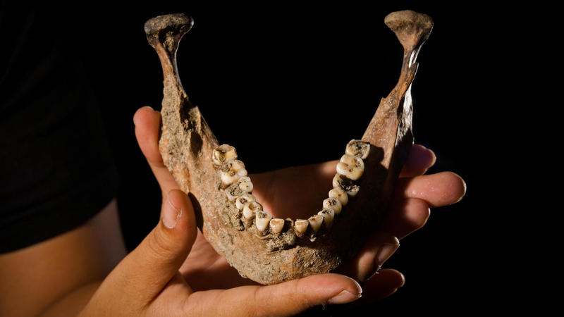 denti archeologia paleodentista